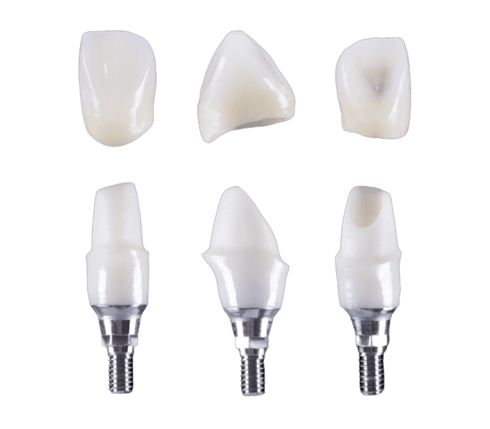 Phục hình trên implant