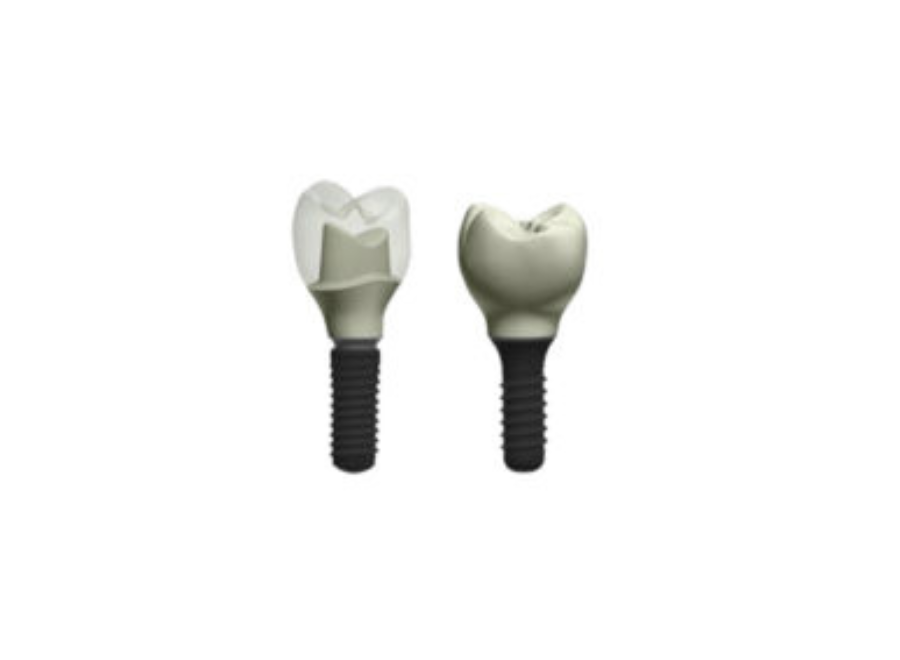 Phục hình trên implant